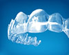 removable braces