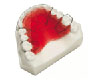 teeth retainers