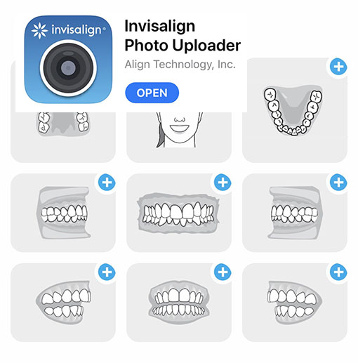 invisalign package