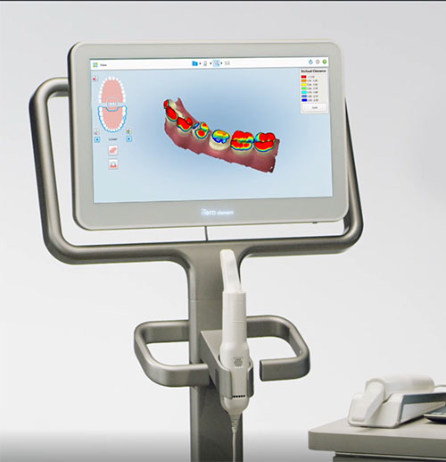 intral oral scanner