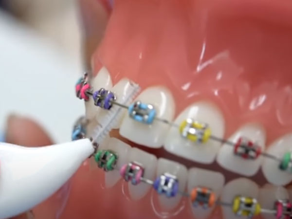 แปรงซอกฟัน